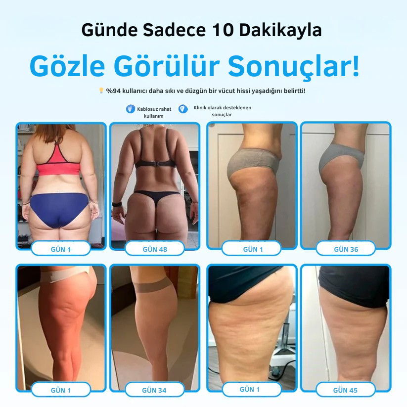 Doktor Medikal™ Selülit Masaj Aleti ( 7 Etkili Derin Dönüşüm Mekanizması )