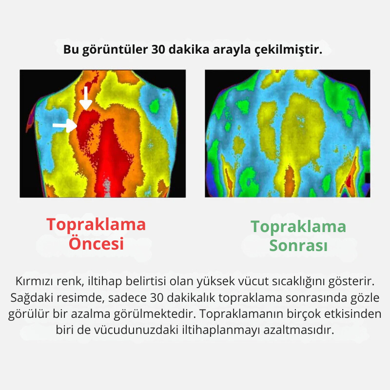 Doktor Medikal Topraklanma Çarşafı