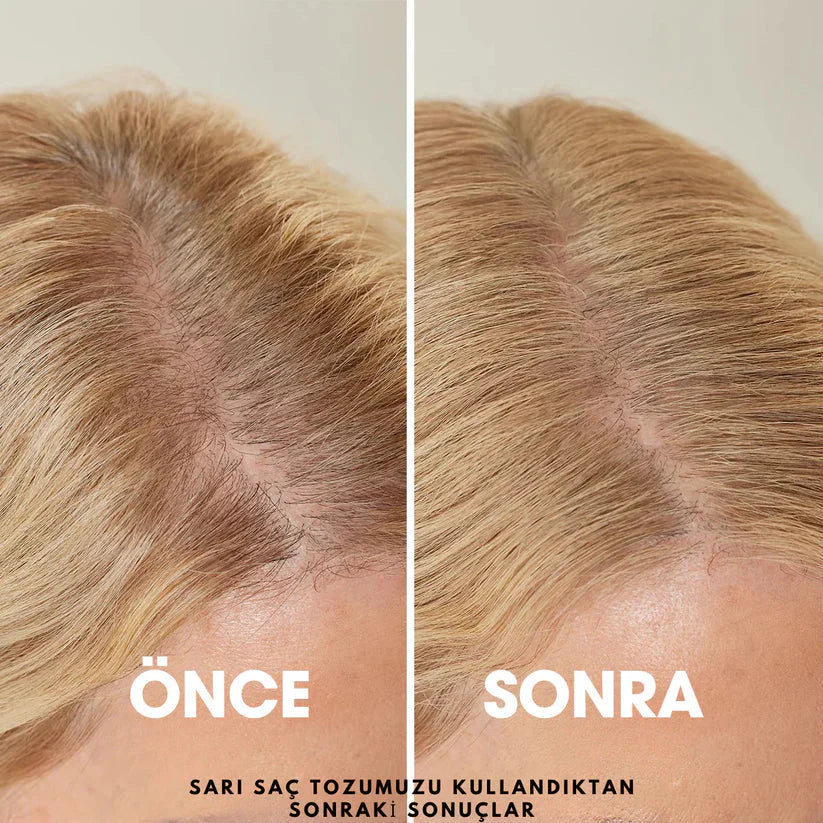 DoktorMedikal Root'd™ Saç Kök Güçlendirici Kapatıcı Pudra (48 Saat Kalıcı Etki)