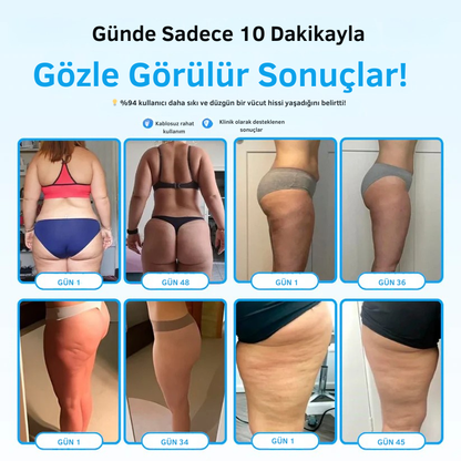 Doktor Medikal™ Selülit Masaj Aleti ( 7 Etkili Derin Dönüşüm Mekanizması )
